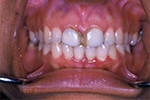Before Dental Treatment - Case Study